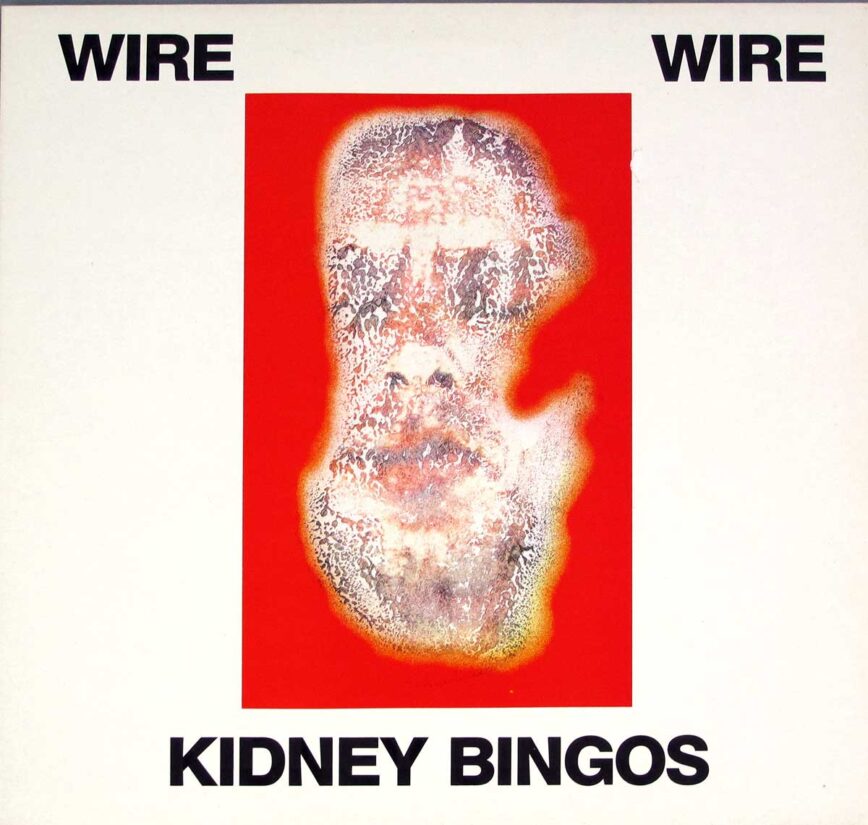 Wire – “Kidney Bingos”
